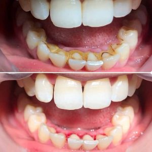 dentiste Ksour Essef Ameni Ben Mariem implantologiste