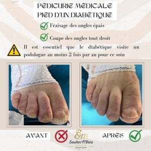podologue Souhir Mhiri soigne le pied avec semelle orthopédiques