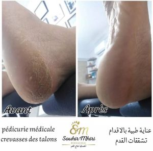 Souhir Mhiri podologue spécialiste du pied et ongles à Ksar Hellal