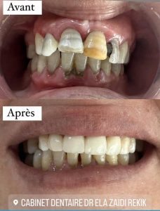 Ela Zaidi Rekik dentiste à Sfax spécialiste en soins dentaires esthétique