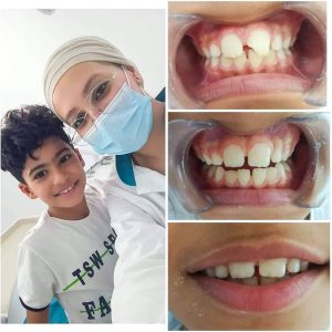 Pédodontie, soins dentaires à Sfax Chez Dr Ela Zaidi Rekik