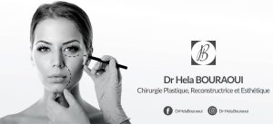 Dr Hela Bouraoui chirurgien et médecin esthétique à Sousse