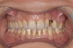 Cabinet dentaire Hamam Lif / Dentiste Rahma Ayachi