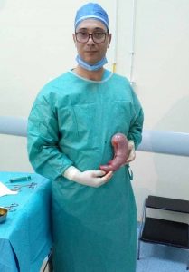 chirurgie-estomac-foie-sousse-dr-skander-louhichi Maladies de foie et pancréas - Dr Louhichi chirurgien Sousse