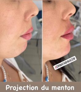 esthétique à Ksar Hellal - laser et soins anti-âge.