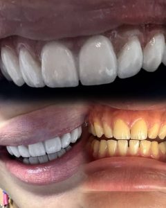 dentiste khezama Est Sousse - Dr Mariem Kerkeni