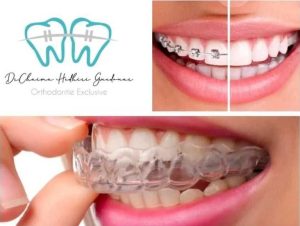 invisalign-appareil-dentaire-hammam-sousse