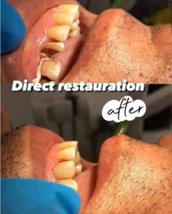 Restauration dents et soins gencives / Dentiste Haifa Cherif