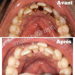 Dentiste Nada Manna - détartrage et blanchiment