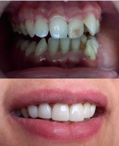 soins dentaires chez dentiste Hammam Sousse Dr Nada Manaa