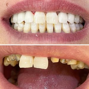 Dentisterie esthétique Akouda / dentiste Marwa Ladhari