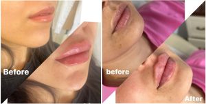 laser et lifting - médecin esthétique Ines Zinelabidine