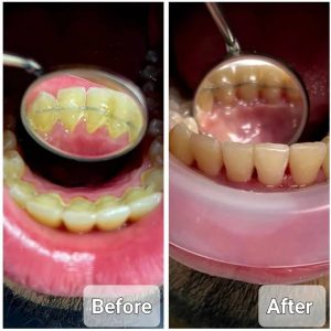 Soins du médecin dentiste - Dr Meriem brini