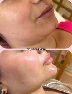 Médecine esthétique et soins visage / dr Yosra Skhiri Sousse