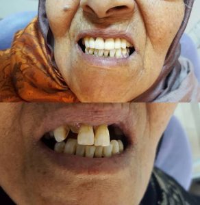 Dr Zied ben Hamed - implant et prothèse dentaire Sousse