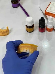 Prothèse et implnat dentaire - Dentiste à cité Ennasr