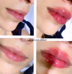 Cabinet Dr Yosra Skhiri - Lipsfiller et soins esthétique Sousse