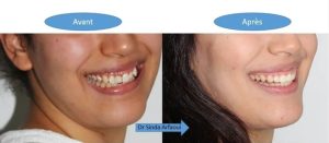 soins orthodontiste Dr Sinda Arfaoui à Bardo