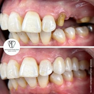 Prothèse dentaire Ksar Hellal / Dentiste Chedy Gam