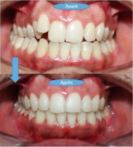 Orthodontie et invisalign à Bardo - Cabinet Dr Sinda Arfaoui