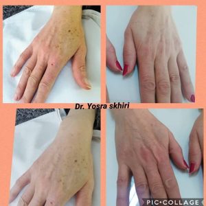 Yosra Skhiri / soins esthétique visage paeu et mains à Sousse