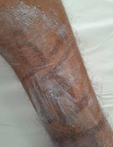 soins peau et laser à Sousse - Dermatologue Bouraoui Badday