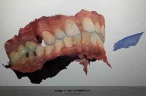 Empreinte numérique - Dentiste Bardo Dr Nour El Houda Ben Amor
