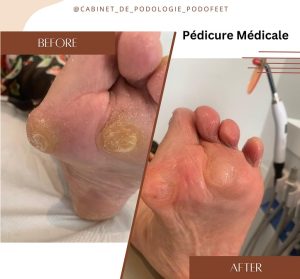 Podologue Ariana Ons Saadaoui- Soins du pied et des ongles