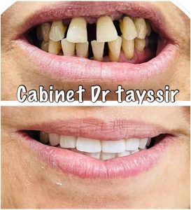 Chirurgien dentiste sosusse Riadh - Dr Tayssir Malek