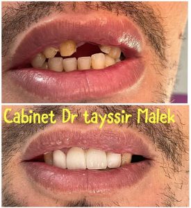 Implantologie et soins dentaires cité Erriadh - Dr Tayssir Malek
