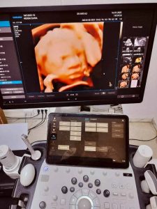 ecogragphie-gynecologique-radiologue-fouchana écographie gynécologue à Fouchana - Radiologue Dr Anis Ali