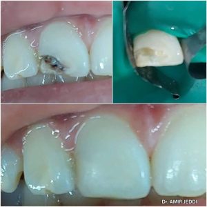 Chirurgien dentiste à Msaken - Dr Amir Jeddi