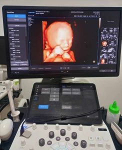 Mammographie et écographie gynécologique - Radio Lab Fouchana