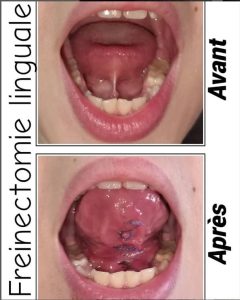 Chirurgie et implant dentaire à Sousse - Parodontiste Dr Rabeb Ben Fredj