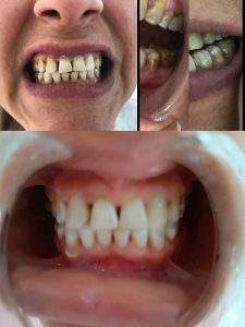 dr-dammak-esthetique-dentaire-implantologie-a-sfax