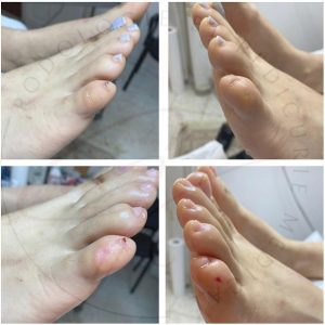 podologie-soins-pied-diabetique-moknine