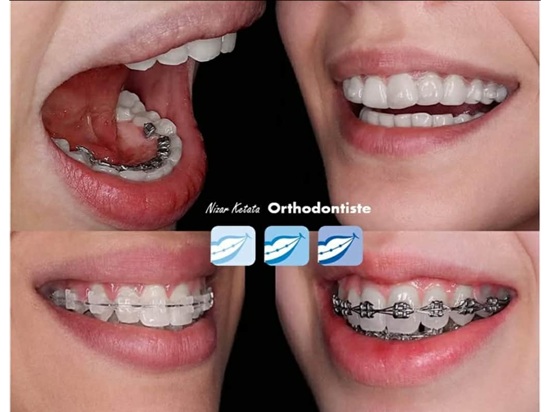 Orthodontiste à Sfax / Dr Nizar Ketata