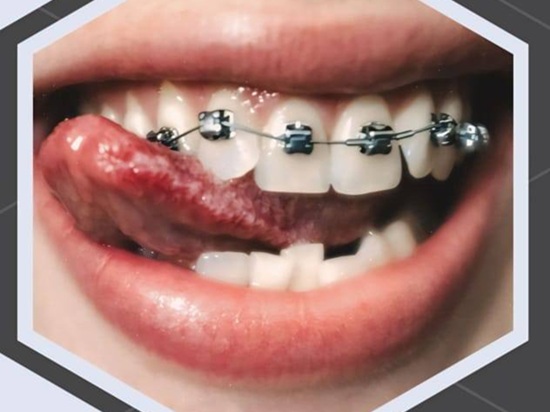 Orthodontiste à Ariana / Dr Omar Masmoudi